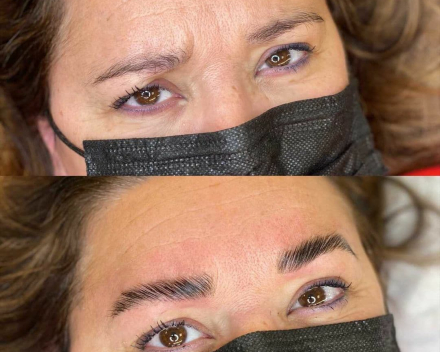 Browlamination